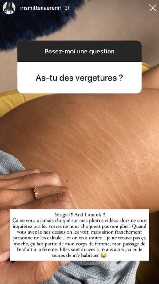 iris-mittenaere-montre-ses-vergetures