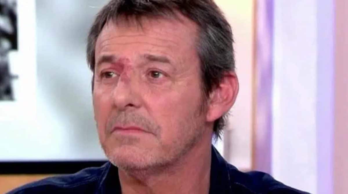 Jean-Luc Reichmann