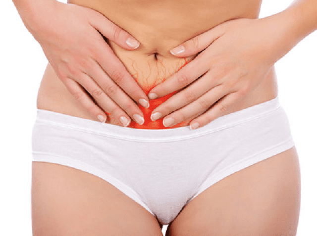 culotte-menstruelle-pour-flux-hémorragique